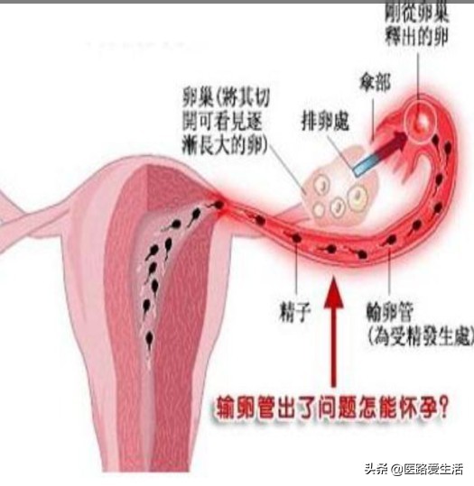 女人不孕找神医后续,女人不孕不育十大原因