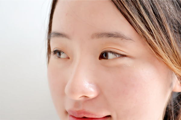 为什么别人腋下不黑,为什么有人腋下只有几根毛