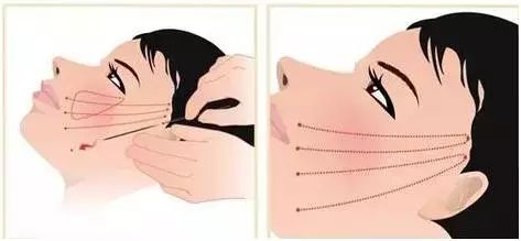 王祖贤到底有没有整容,王祖贤整容成功了吗