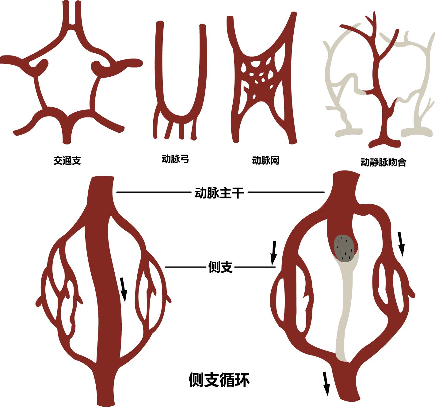 冠脉侧支循环建立条件,什么是冠脉侧支循环