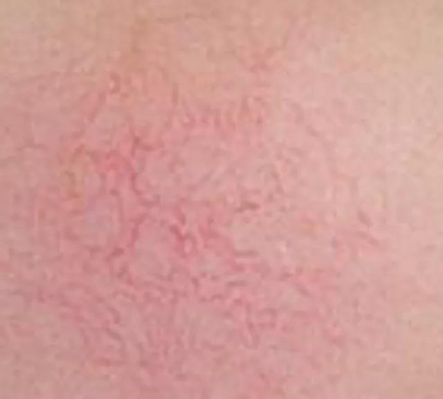 韩后神经酰胺补水保湿面膜,C5神经酰胺保湿修护面膜