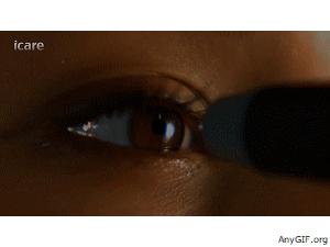 孩子不肯接受眼压计检查,小朋友有必要测眼压吗有必要查吗