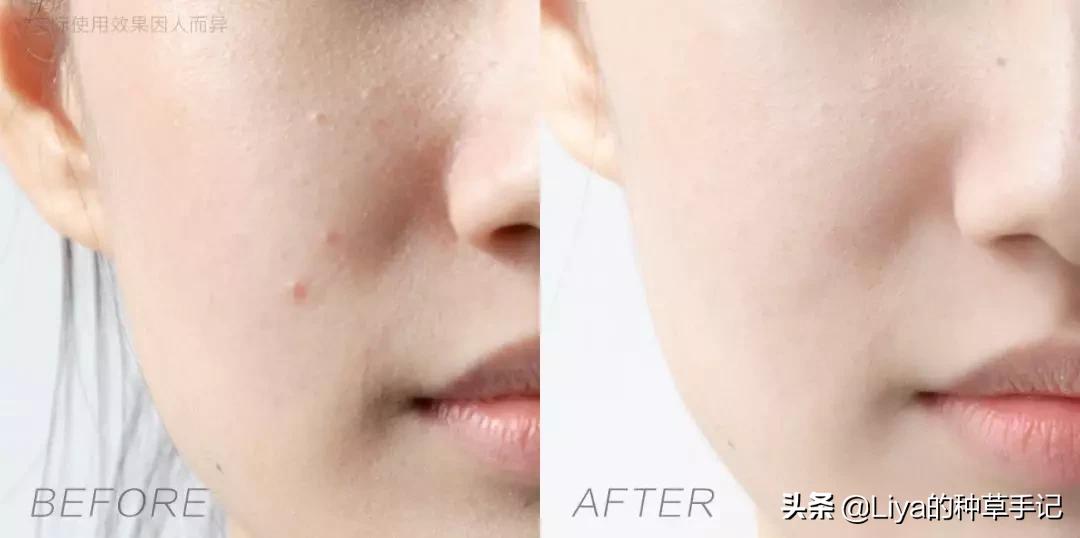 外国都在用的洗面奶,国外效果好的洗面奶