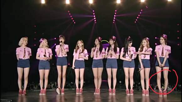 o型腿怎样矫正过来,严重o型腿怎么矫正最有效的动作