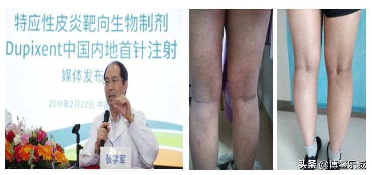 9月11日，皮肤专家张学军、杨森教授坐诊博鳌超级医院，速约！