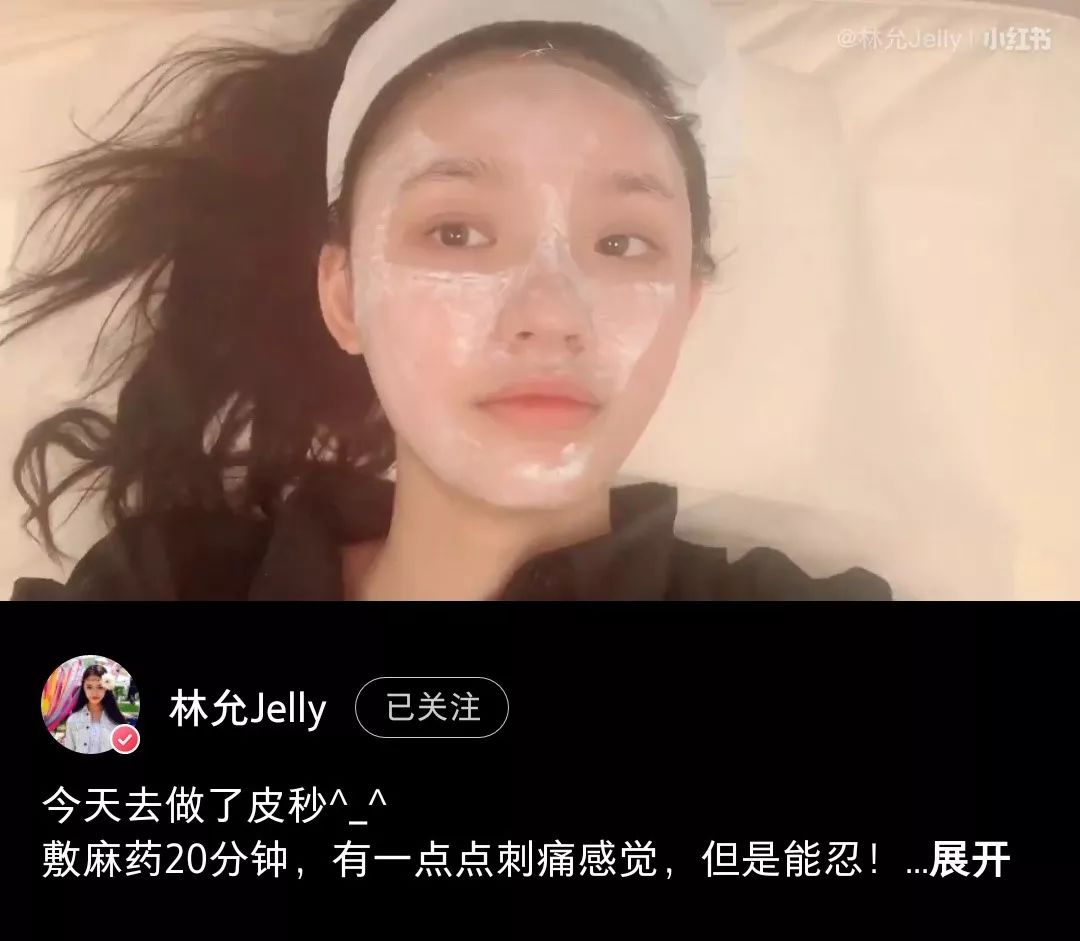 林允大s,林允美白的视频