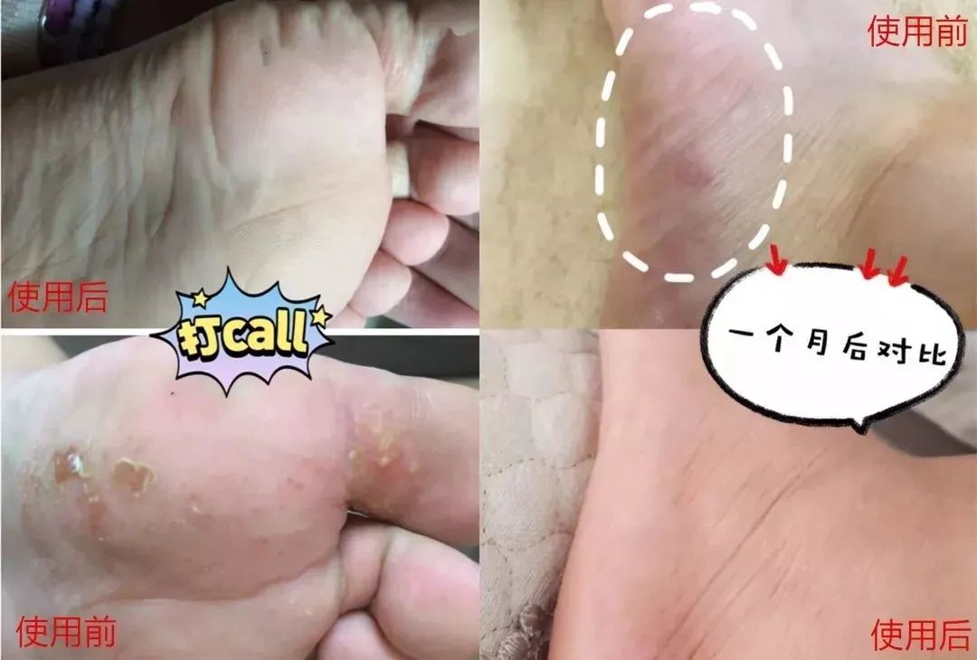 光脚不穿袜子穿鞋的好处,光脚不穿袜子会不会臭脚