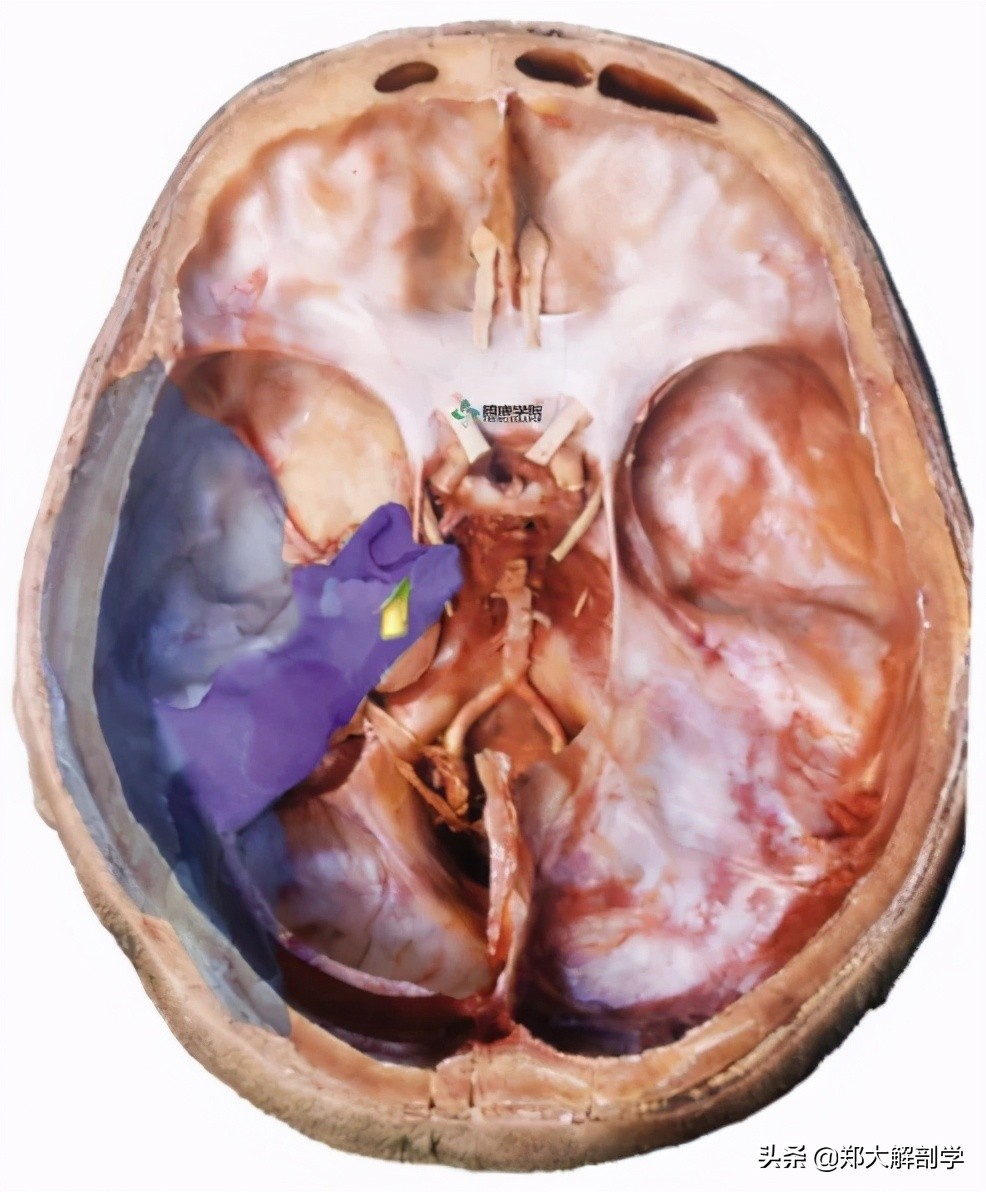 偏头痛怎么用手法缓解,偏头痛的手法治疗