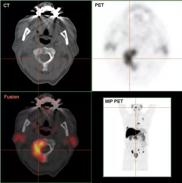 都说鸡蛋是发物是真的吗,鸡蛋怎样吃好消化易吸收营养好