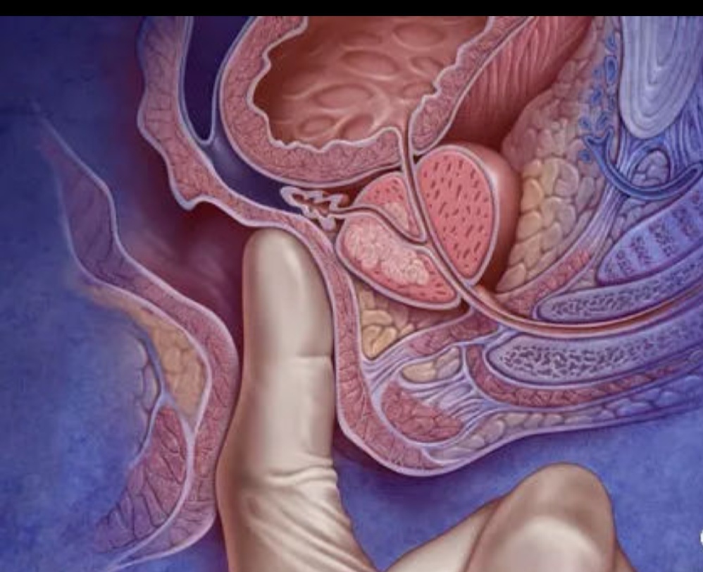 直肠癌术后造瘘口的预见性护理,直肠癌术后吻合口瘘护理措施