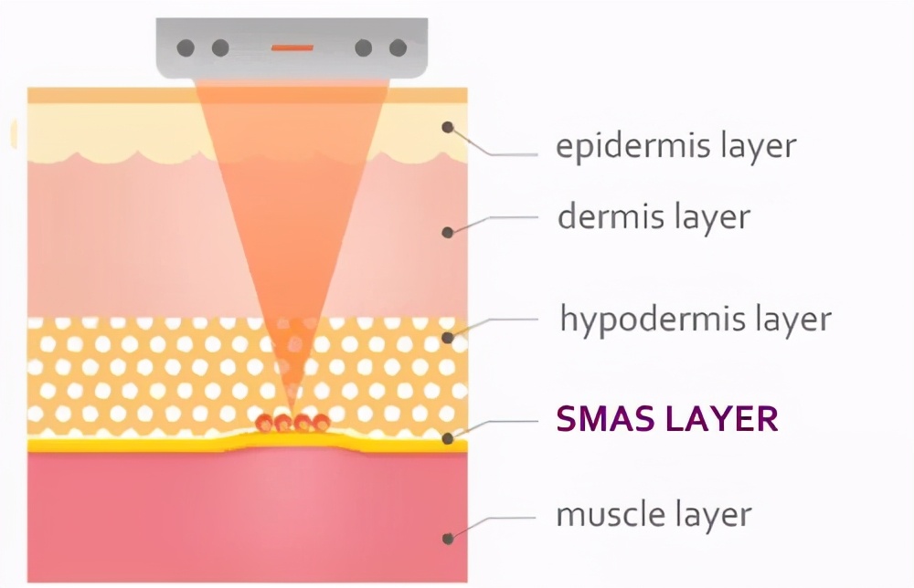 最新款射频美容仪,最好用的家用射频美容仪器