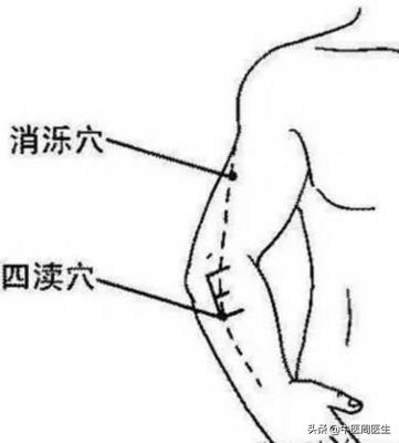 乳腺增生4期,乳腺增生食疗法大全集