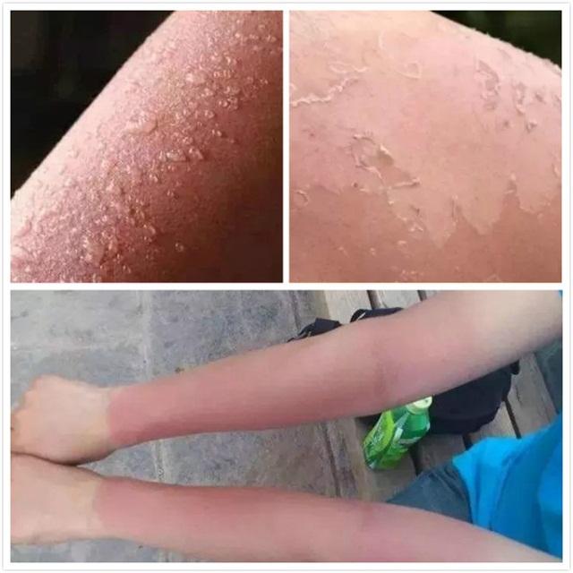 军训防晒护肤全套流程,军训晒黑了怎么快速变白小技巧