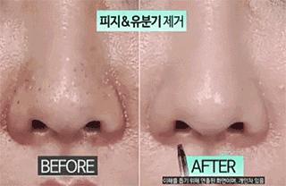 洗脸清洗黑头,洗脸清洁去粉刺