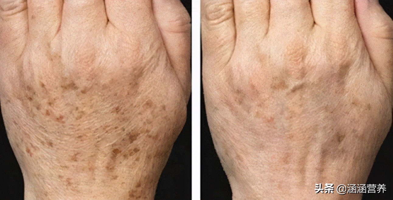 去斑点最有效的食物和蔬菜有哪些,吃什么食物能排出体内斑点黑色素