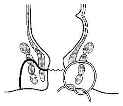 肛瘘手术比生孩子还痛吗,做完肛瘘手术疼痛怎么解决
