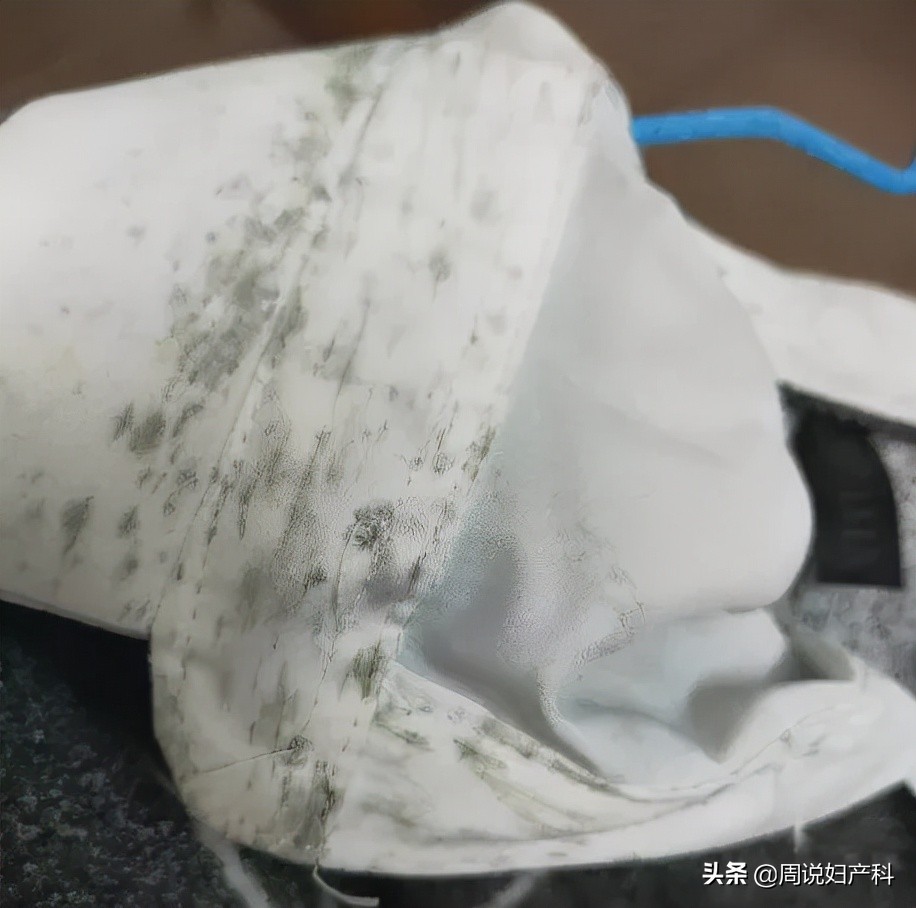 *裤内**长霉点还能穿吗？女性更要注意