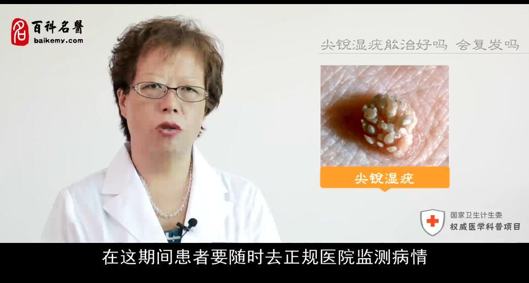 尖锐性湿疣能治好吗会复发吗,尖锐性湿疣治好会复发吗