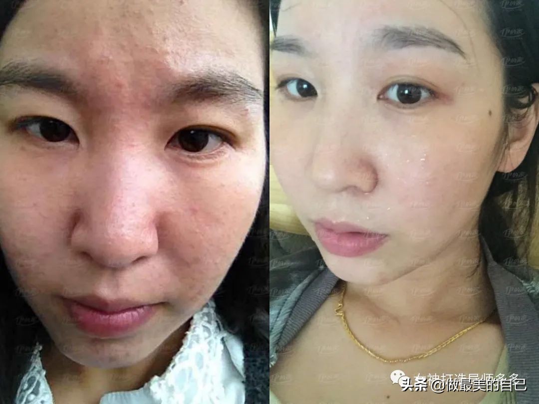 斑点暗黄肌最全的改善小技巧,都在这里