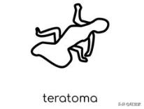 男人也有孕反应腰酸吗,男人也怀孩子