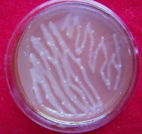 植物转基因有什么是转不出来的,转基因植物的内标准基因有哪些