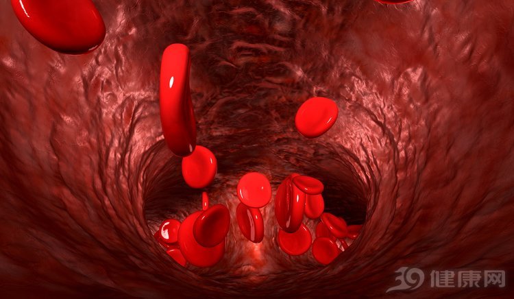 做完心脏支架为什么会发生心颤,心血管堵了80%一定要做支架吗