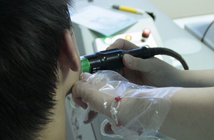 白癜风308激光后多久能照太阳光,白癜风用308激光治疗后怎么变白了