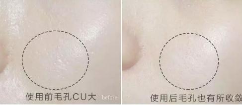 吸黑头神器去粉刺角质收缩毛孔,皮肤清洁收缩毛孔黑头角质