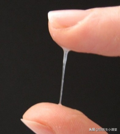 同房后多久可以做妇检?