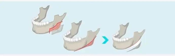 「韦敏精讲」与五官风格不相符的典型方脸应该如何改善