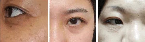 眼霜到底有没有用啊,眼霜里面有什么成分不能用