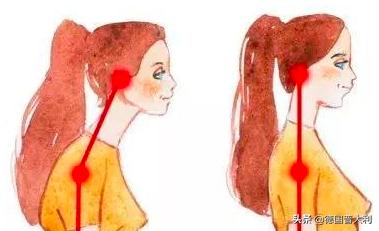 乌龟脖到底还有没有救