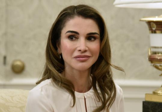 凯特王妃整形了吗,王妃凯特有没有整容