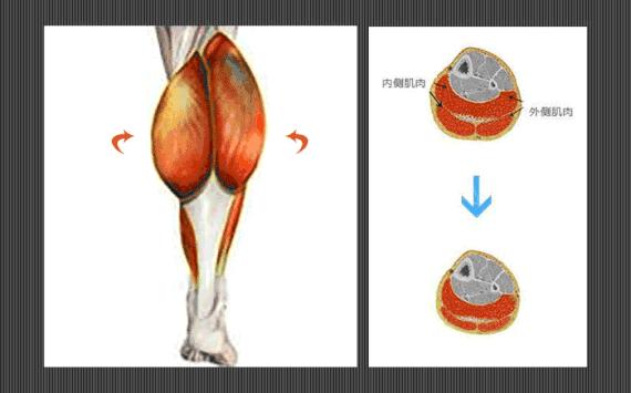 挑筋断骨切胃，那些为了美不要命的女人到底有多可怕