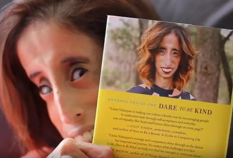 世界上最丑陋的女孩儿,世界最丑的女孩