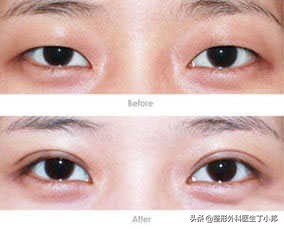 整容成功逆袭的女人,整容整形成功逆袭案例