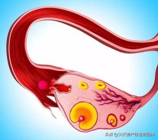 女生身体里的这把小伞千万别生病！