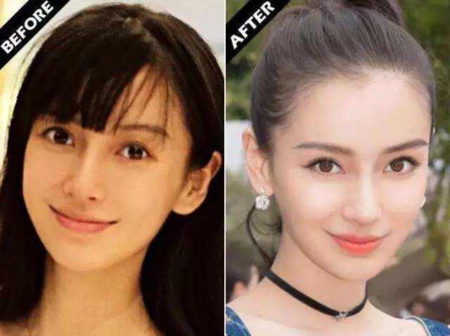 皮肤有的地方暗黄,怎么解决皮肤暗黄