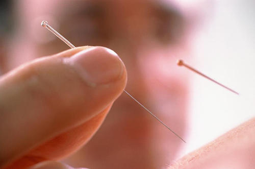 为什么缺乏维生素b会口腔溃疡,口腔溃疡是缺乏维生素什么导致的