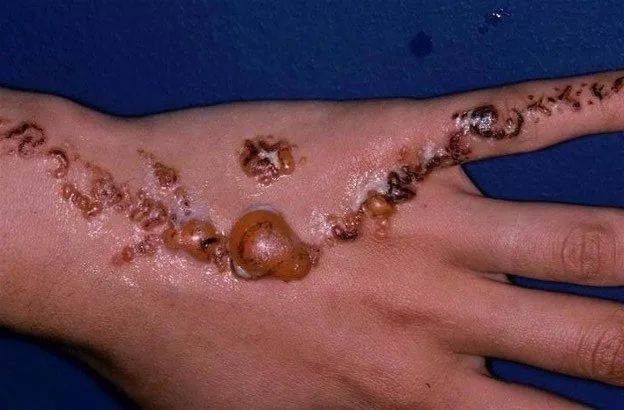 海娜花染发有毒吗,染发剂海娜花有毒吗