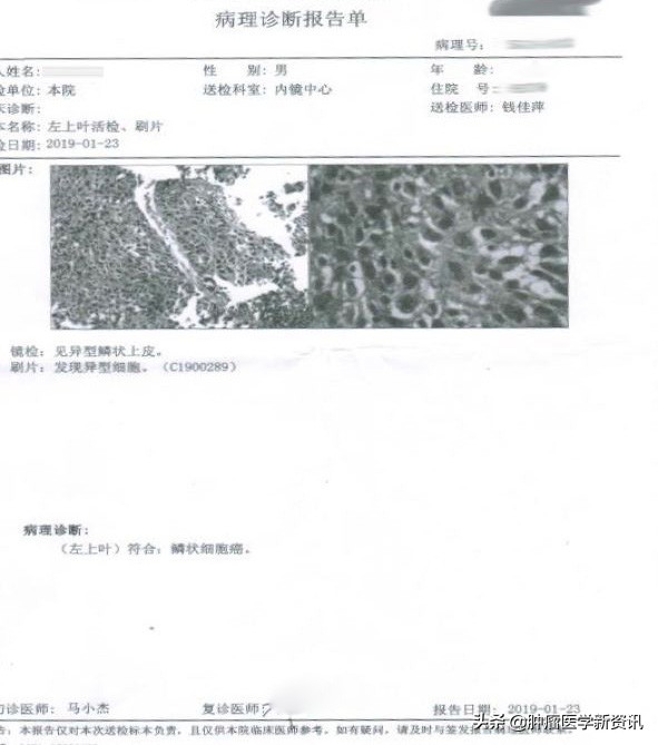 肺癌早期的6个信号中医治癌,肺癌正确的抗癌方法