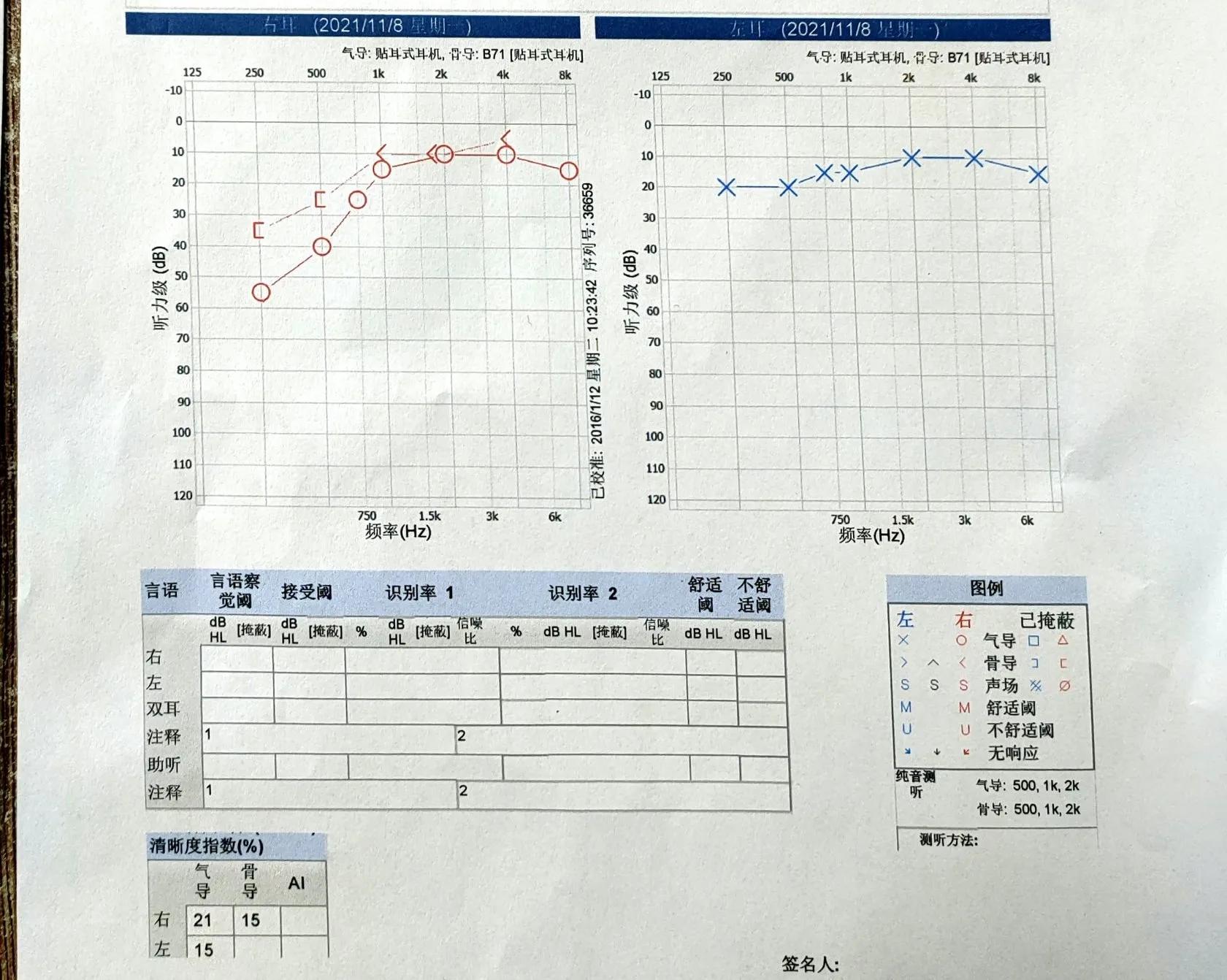 突发性耳聋住院需要人照顾吗,突发性耳聋住院大概费用是多少