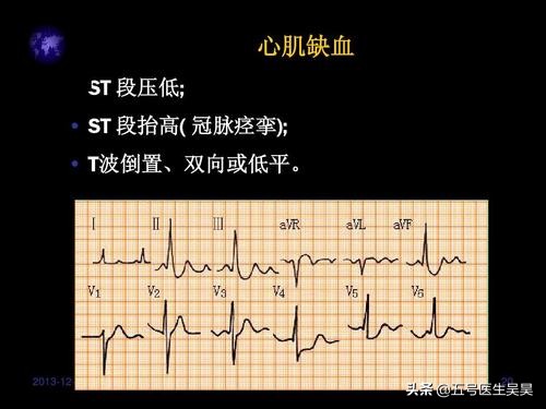 无痛胃镜检查前的准备和注意事项,无痛肠胃镜做之前需要注意什么