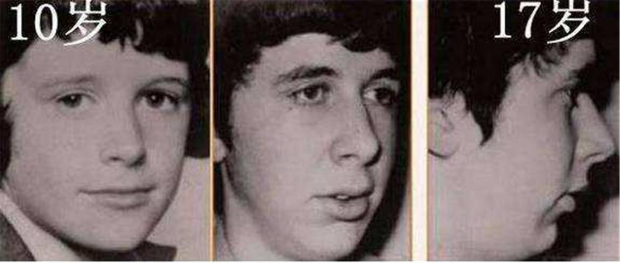 儿子越长越像大猩猩,长得像大猩猩的脸型