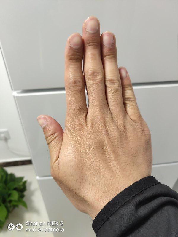 自觉心里不舒服是焦虑症吗,焦虑症总是自觉身体不适