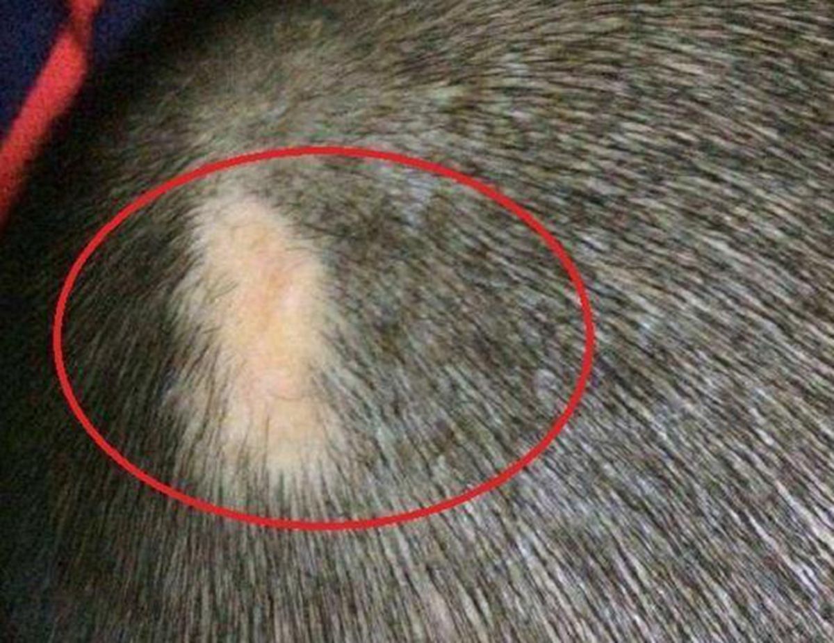 顺产剖产哪个对孕妇好,顺产剖腹产哪种对女人好