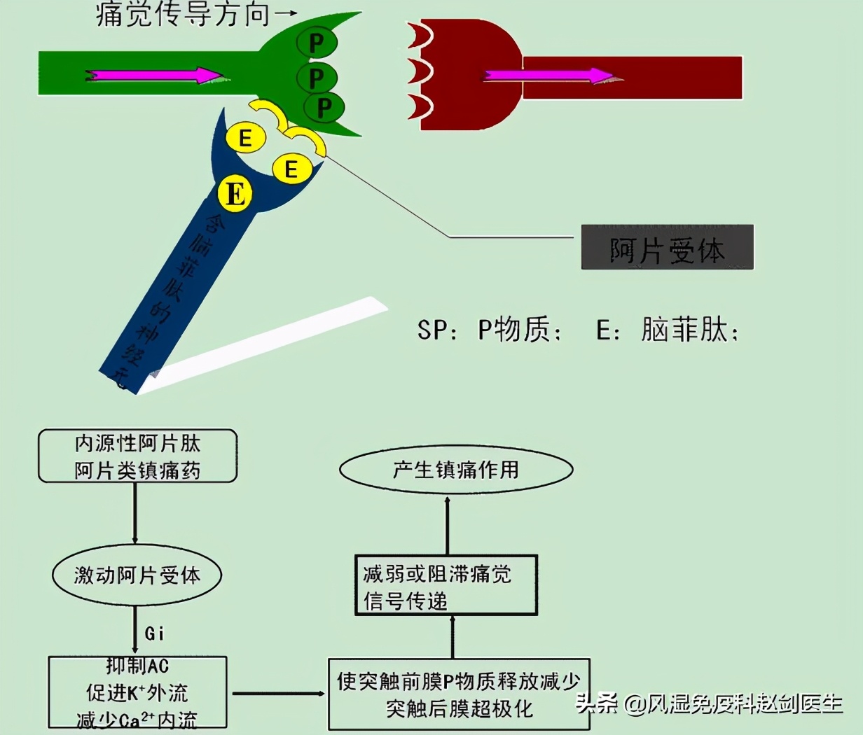 骨关节炎吃药可以做理疗吗,退化性骨关节炎需要终身服药吗