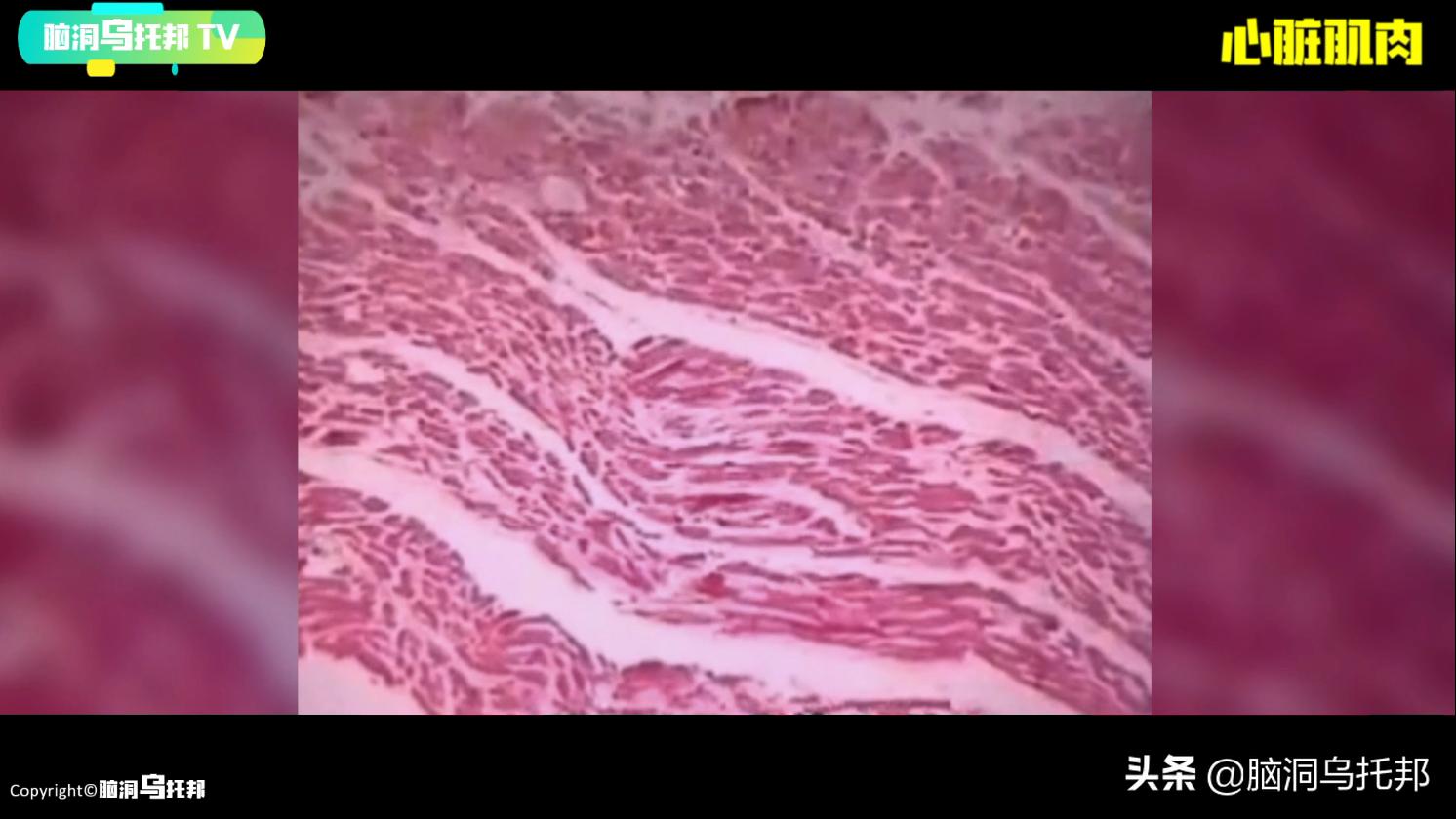 遭到核辐射被抢救的日本人,遭核辐射后强行救治83天