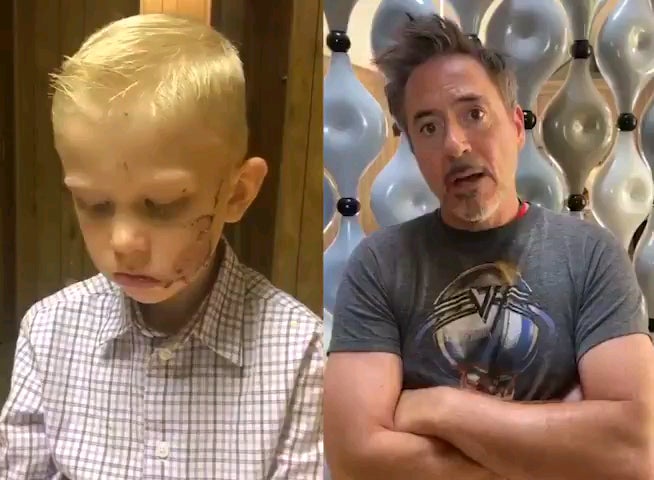 真英雄！6岁男孩为救妹妹被狗咬伤，“复仇者”送来了最棒的礼物