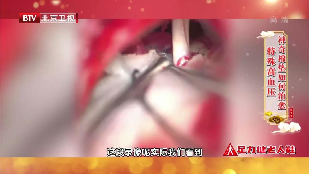 眼皮跳财运到?当心是一种特殊高血压!专家:用一块棉垫就能治愈